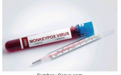 KEMENKES: Hasil Tes 17 WNI yang Diduga Terjangkit Cacar Monyet Negatif